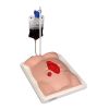 Freddie Fistula Vaardigheidstrainer met koffer