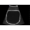 SonoEZ echografietrainer 'Urineblaas'
