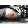 EZ-wonden – Professionele wondsimulatieset