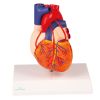 Hart met bypass