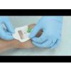 Mepore IV infuuspleister, 5,5 x 5 cm, 100 x 1 stuk