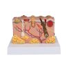 Pathologisch huidmodel - afbeelding 3