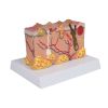 Pathologisch huidmodel - afbeelding 4