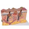 Pathologisch huidmodel - afbeelding 5