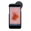 HEINE iC1 digitale dermatoscoop set met contactplaat met schaalverdeling, smartphone-case iC1/6 voor Apple iPhone 6 en 6s, USB-kabel en medisch goedgekeurde voeding
