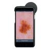 HEINE iC1 digitale dermatoscoop set met contactplaat met schaalverdeling, smartphone-case iC1/6 voor Apple iPhone 6 en 6s, USB-kabel en medisch goedgekeurde voeding