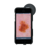 HEINE iC1 digitale dermatoscoop set met contactplaat met schaalverdeling, smartphone-case iC1/5 voor Apple iPhone 5s en SE (1e generatie), USB-kabel en medisch goedgekeurde voeding