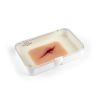 Wondmoulage 'gesneden met glasfragment'