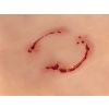 Wondmoulage 'menselijke beet' - afbeelding 5