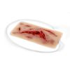 Wondmoulage laceratie