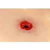  arm met bloedingsfunctie - afbeelding 3