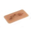 Wondmoulage hematoom vers - afbeelding 3
