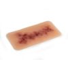 Wondmoulage Hematoom ouder - afbeelding 3