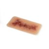 Wondmoulage Hematoom ouder - afbeelding 4