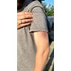 Wondmoulage Hematoom ouder - afbeelding 7