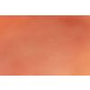 Wondmoulage 1e graads brandwond - afbeelding 5