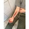Wondmoulage Zelfmoordpoging - afbeelding 6
