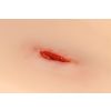 Wondmoulage Steekwond nek - afbeelding 5