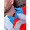 Wondmoulage Steekwond nek - afbeelding 7