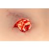 Wondpresentatie open fractuur enkelgewricht - afbeelding 5
