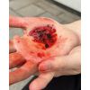 Wondmoulages - Set Standaard - afbeelding 2