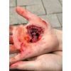 Wondmoulages - Set Standaard - afbeelding 3