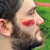 Wondmoulages - Set Standaard - afbeelding 20