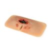 Wondmoulage sacrale decubitus