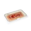 Wondmoulage veneuze beenulcus