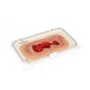 Wondmoulage veneuze beenulcus