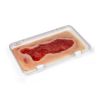 Wondmoulage veneuze beenulcus