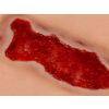 Wondmoulage veneuze beenulcus