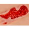 Wondmoulage arteriële beenulcus