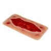 Wondmoulage arteriële beenulcus