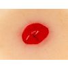 Wondmoulage verzonken colostoma, zelfklevend