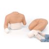 Stompverband bovenlichaam