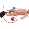 CRiSis noodpop voor baby's - afbeelding 2
