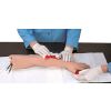 EHBO-arm
