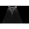 SonoEZ echografietrainer 'Urineblaas' - afbeelding 6