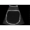 SonoEZ echografietrainer 'Urineblaas' - afbeelding 7