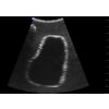 SonoEZ echografietrainer 'Urineblaas' - afbeelding 8