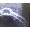 Echografie trainingsgezicht - afbeelding 6
