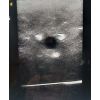 Echografie - Regionale anesthesie - Simulator - afbeelding 4
