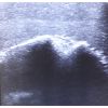 Echografie - Oefenmodel Schouder - afbeelding 6