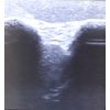 Echografie - Oefenmodel Schouder - afbeelding 7