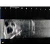 SonoEZ echografietrainer 'Schildklier' - afbeelding 8
