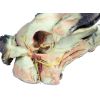 Hondenkop, oppervlakkige en diepe dissectie